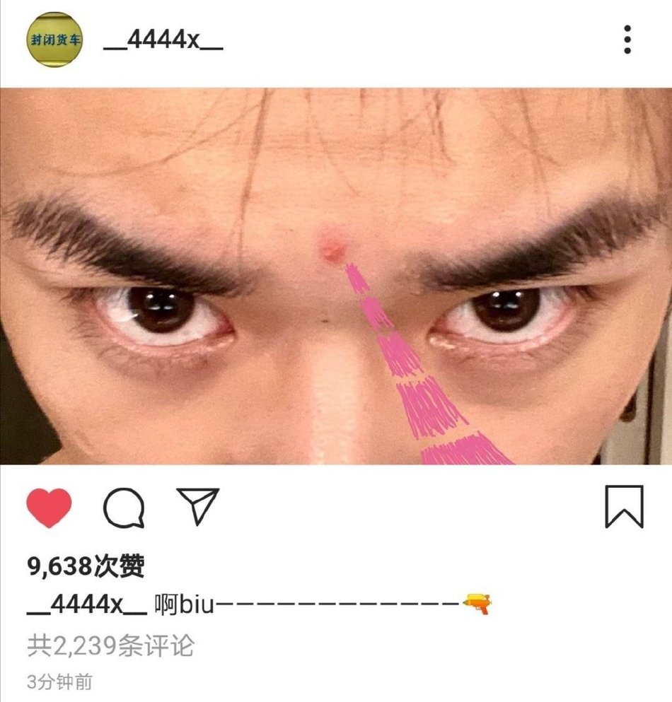 组图:易烊千玺发自拍晒青春痘 委屈撒娇变小可爱萌化粉丝_高清图集