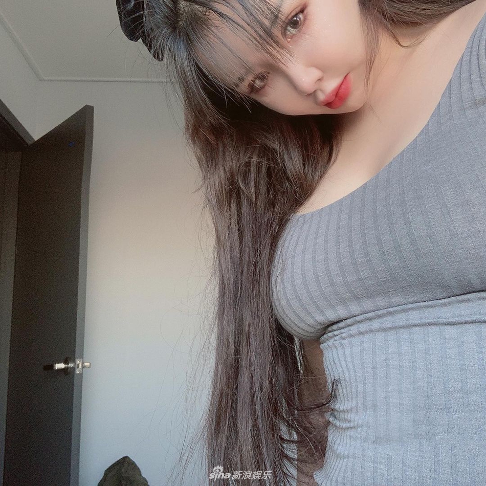 組圖：韓女星樸春晒減肥後近照 嘴脣腫了疑似又變臉