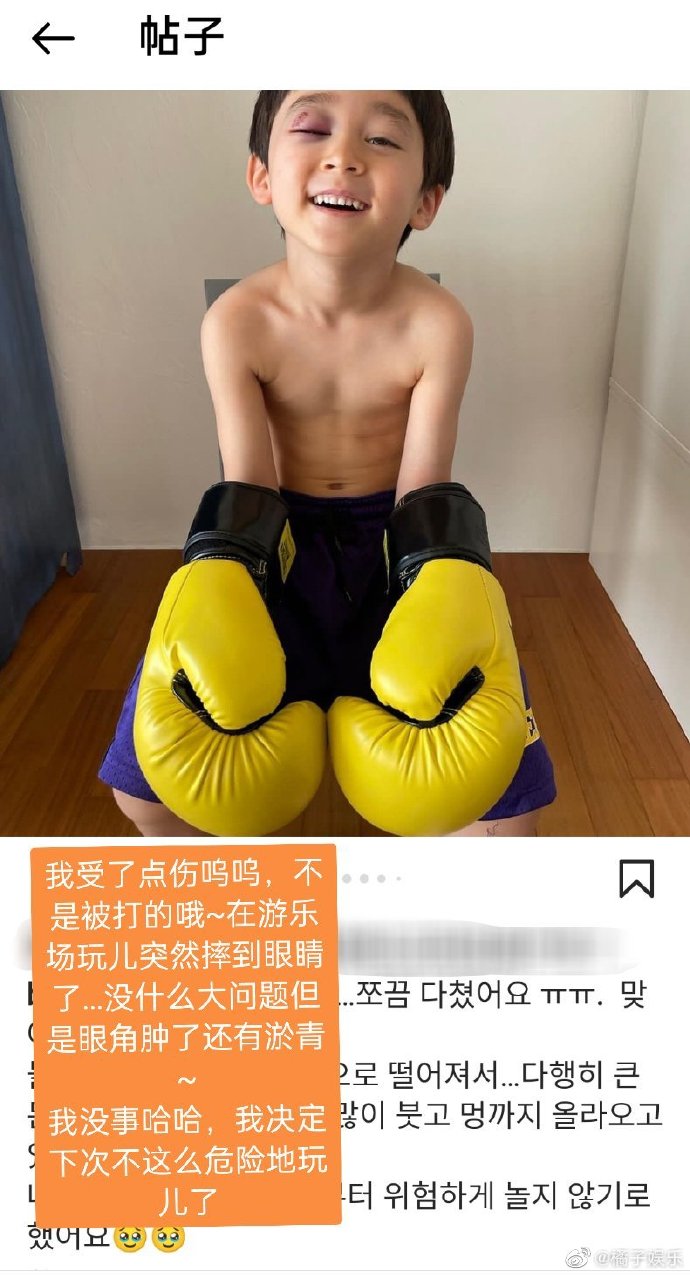組圖：本特利遊樂場玩耍時摔倒 眼部受傷淤青腫脹惹網友心疼