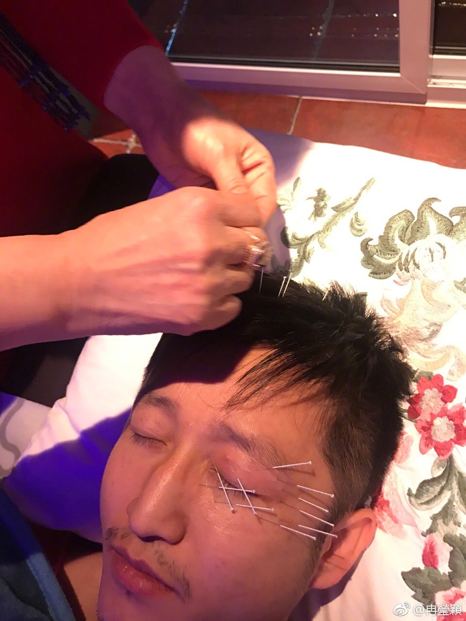 冉莹颖晒邹市明针灸照 称积极康复中