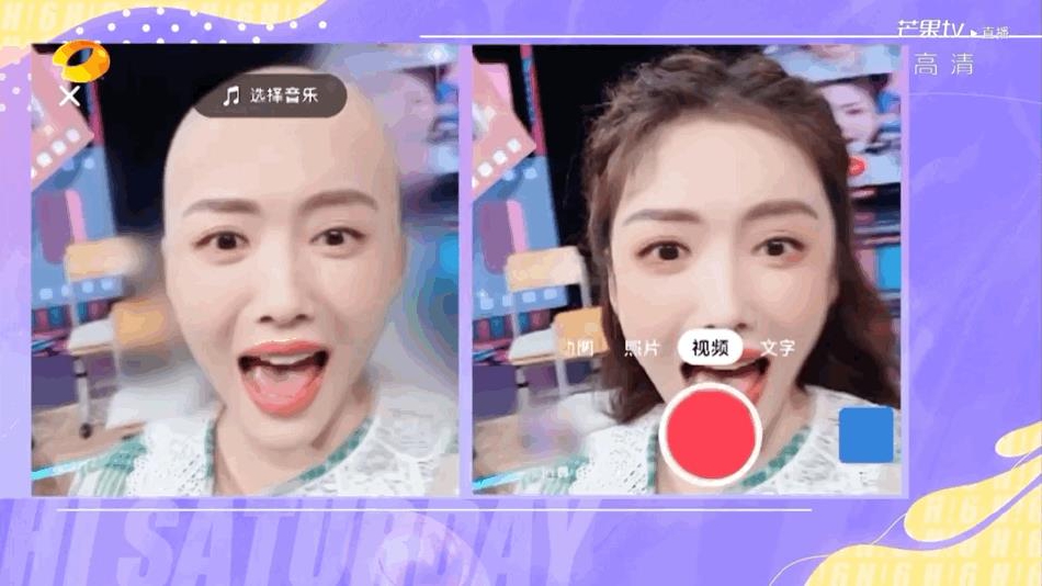 组图：蔡文静晒开学复古造型又甜又酷被自己的“光头”吓到第1张图片