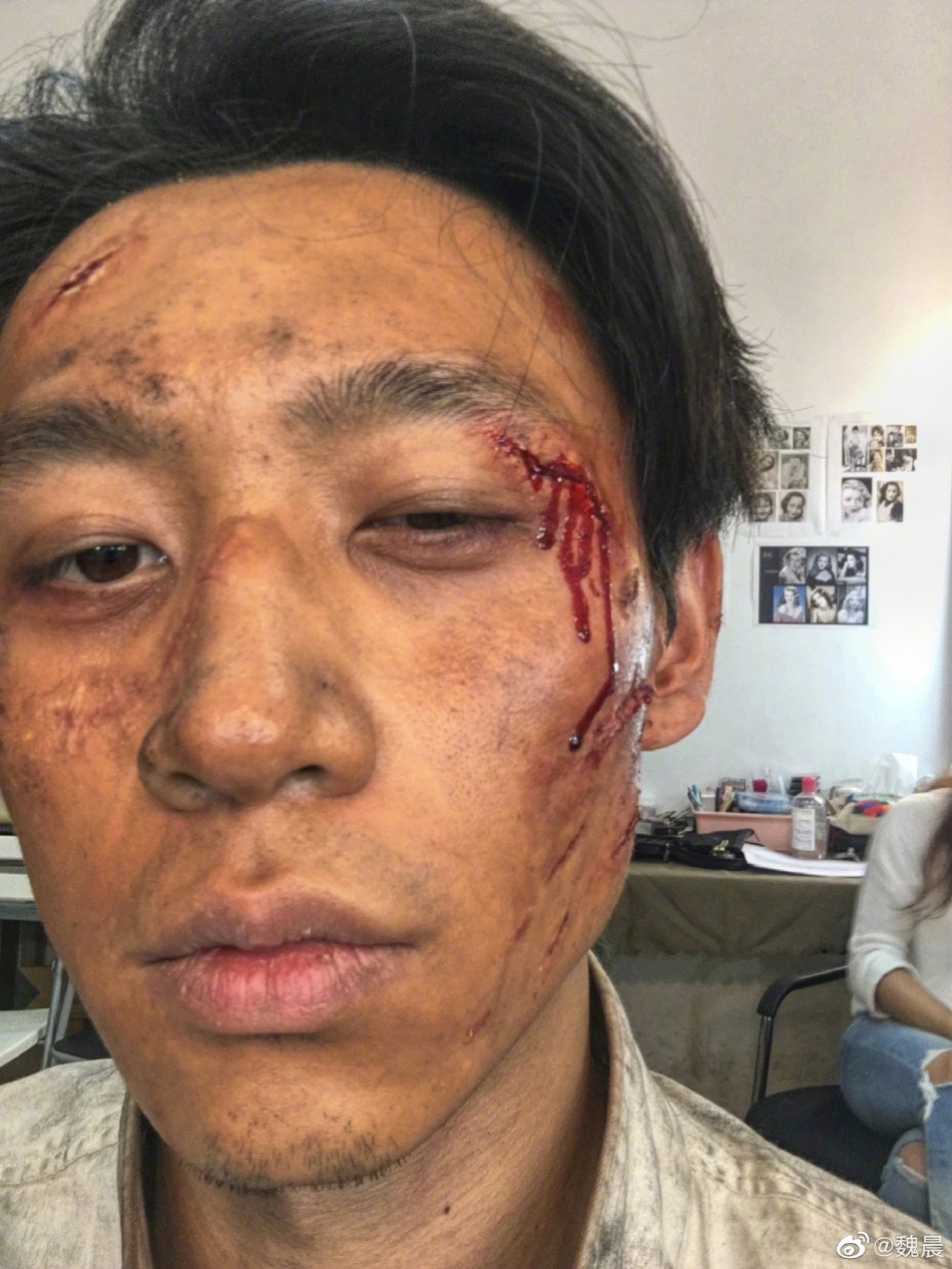 组图:魏晨晒16宫格《八佰》受伤妆剧照 赞制作团队细节至上