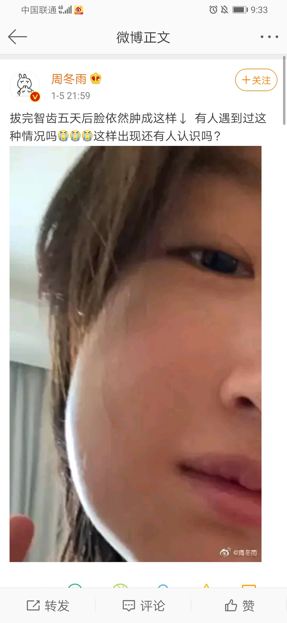 组图 周冬雨拔完智齿后晒照 撞脸被蜜蜂蛰了的狗狗心疼又搞笑