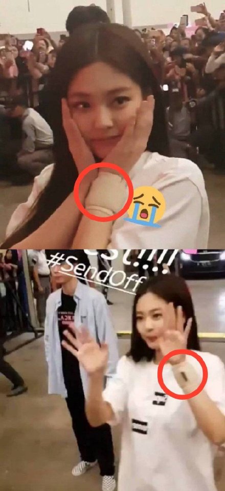 组图：BLACKPINK成员JENNIE受伤手腕淤青 直播安慰粉丝笑称没事