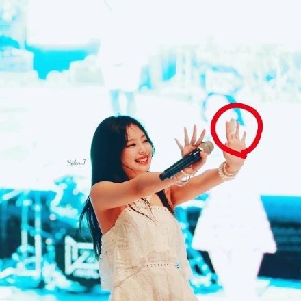 组图：BLACKPINK成员JENNIE受伤手腕淤青 直播安慰粉丝笑称没事