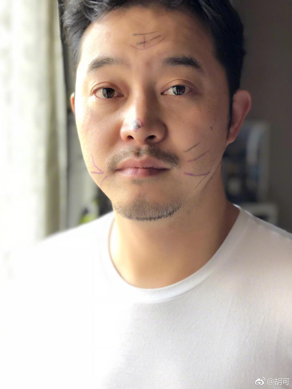 4 新浪娱乐 胡可晒出沙溢的近照,写道:今天一大早儿,安吉和鱼儿给