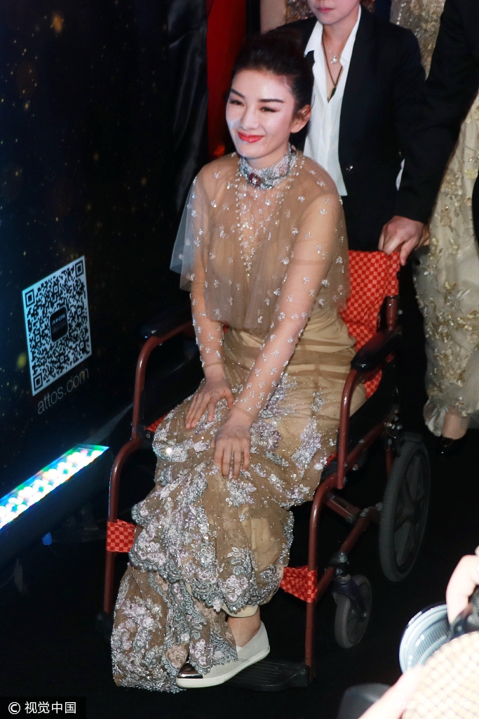 组图:腿伤不忘凹造型 黄奕坐轮椅依旧透视秀美腿_高清图集_新浪网