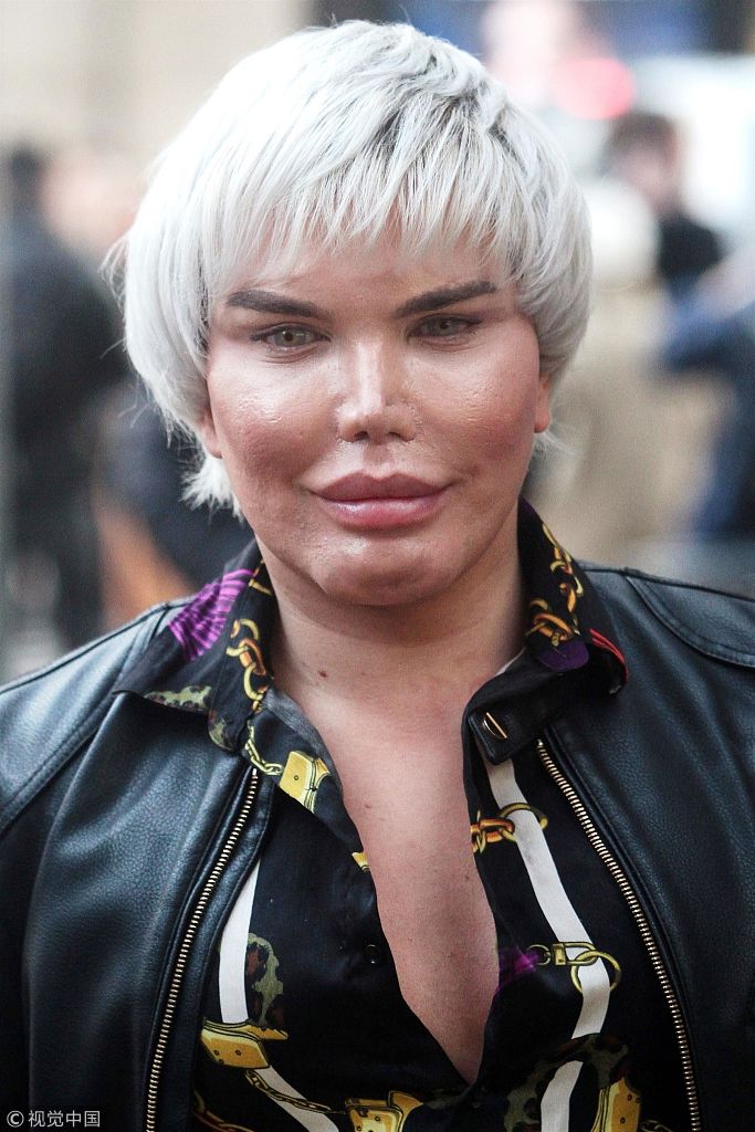 组图:整容狂魔罗德里戈面部似水肿 街头努力比v笑不出来