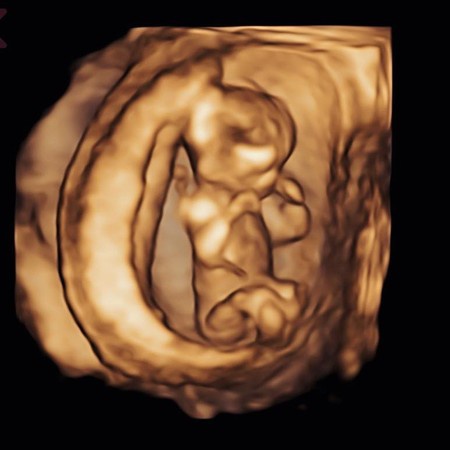 许仁杰晒出b超照片