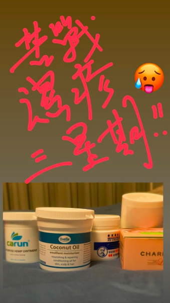 郑秀文自曝患湿疹已治疗三星期