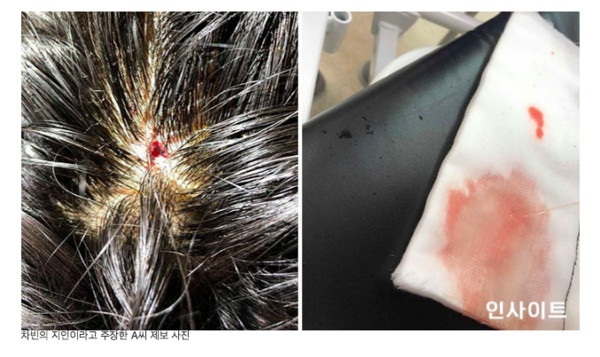 韩男团成员自曝遭队友暴打头部出血脸上伤痕累累