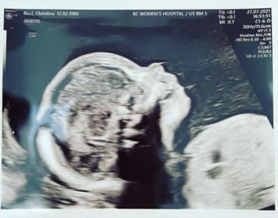 里奇分享的胎儿超声波照片