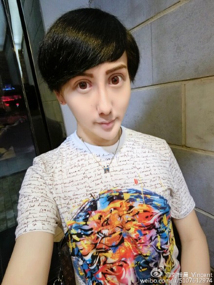 恐怖蛇精男自曝整容照眼皮浮肿似猪头