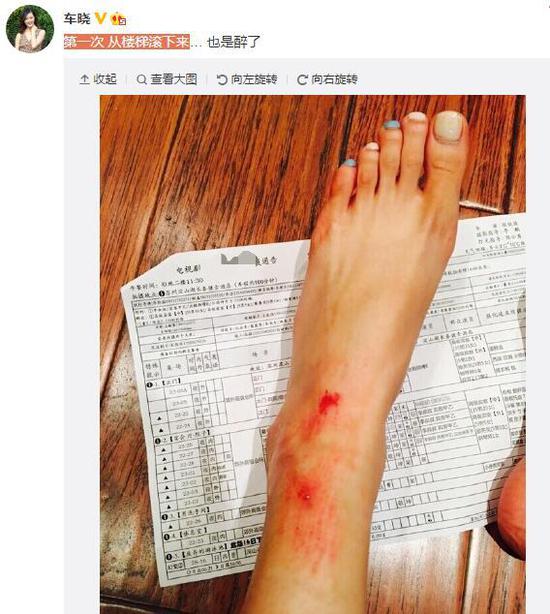 车晓微博截图