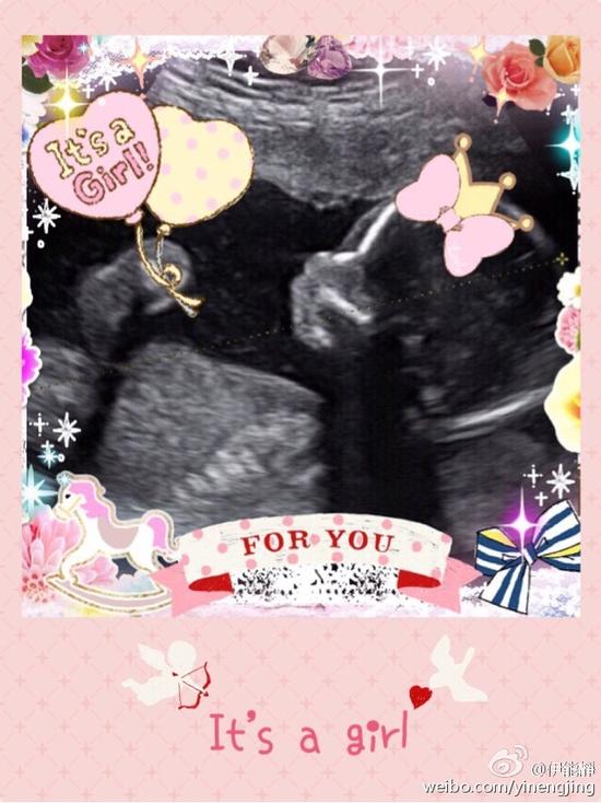 伊能静晒超声波照片