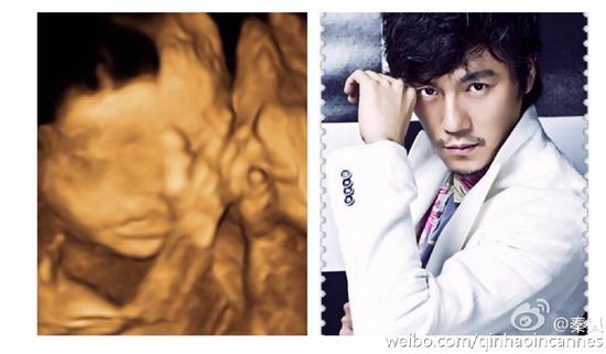 秦昊晒女儿b超照 父女神同步自侃很文艺