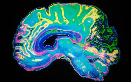 brain海报