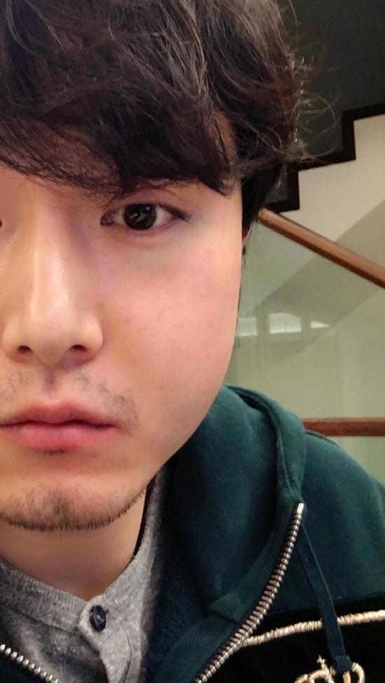 大写的心疼!李东学回应毁容自侃白胖