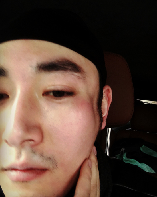 李东学回应毁容自侃白胖