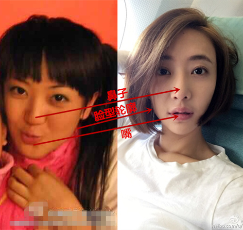 网曝姜尘整容对比图