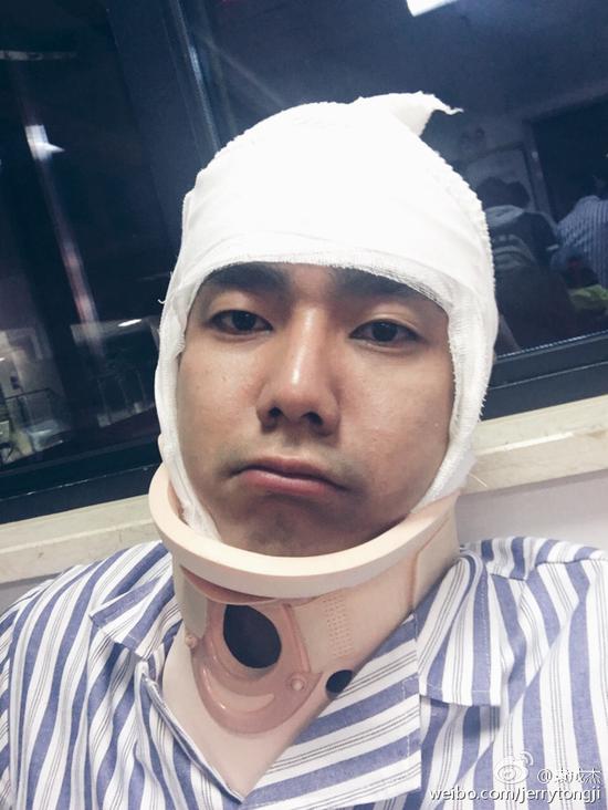 袁成杰疑受伤包裹似粽子