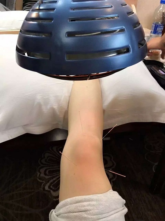 景甜拍摄新戏腿伤复发网友直呼太心疼