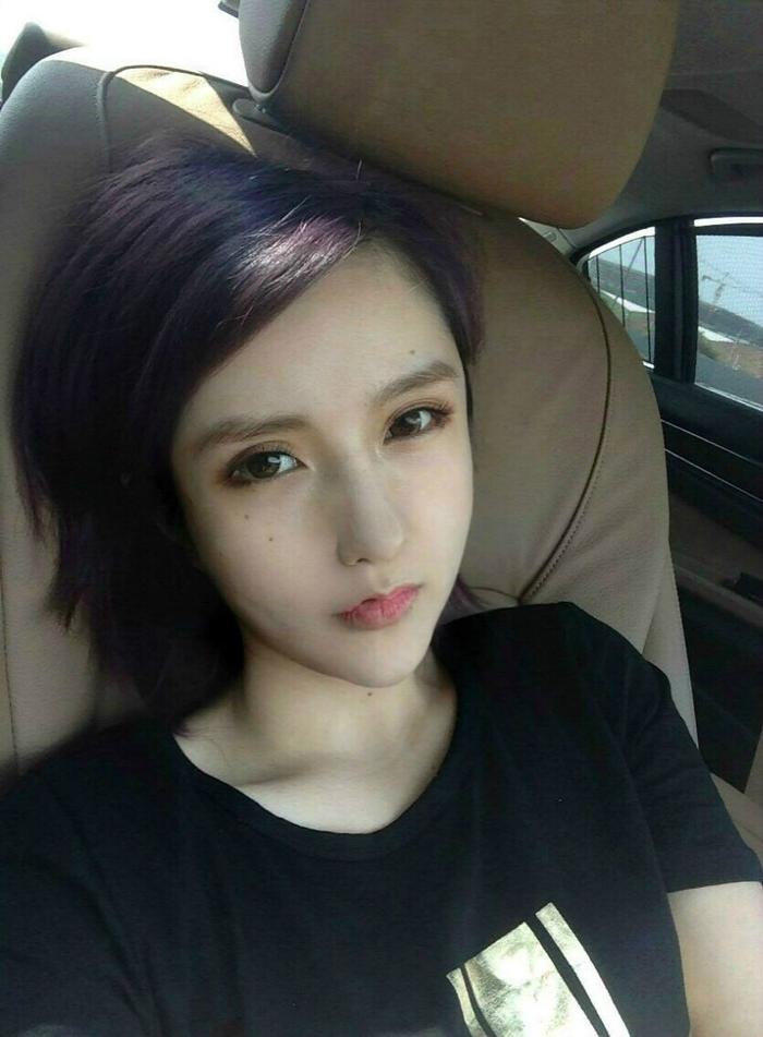 沉珂（图）