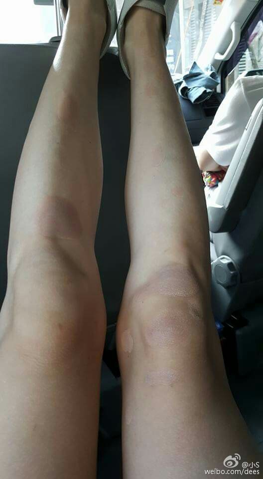 11月5日上午,小s[微博]更新微博晒出坐在车内的腿照自拍照,从照片可以