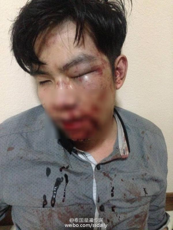 泰国明星指示保镖围殴高级将领儿子,此事件引起了总理