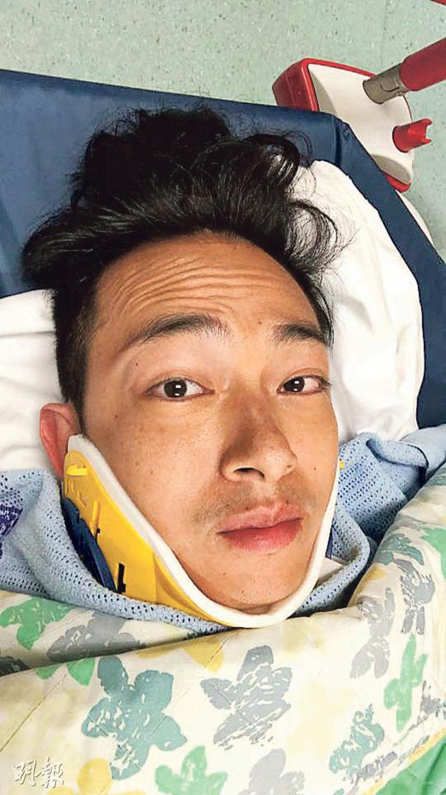 梁烈唯上传意外后躺在担架床上的照片，幸照了X光证实没大碍，已可以立刻出院了。