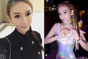 刘乔安脸上布满红色斑点 自称变“毁容状态”|刘乔安|毁容|神经失调_新浪娱乐_新浪网