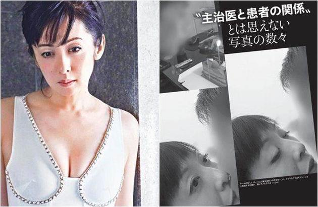 齐藤由贵是资深玉女，现年51岁的她却爆出和家庭医生搞不伦