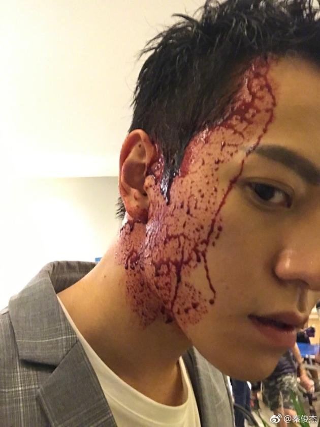 秦俊杰饭点晒满脸血浆自拍打趣粉丝减减肥吧