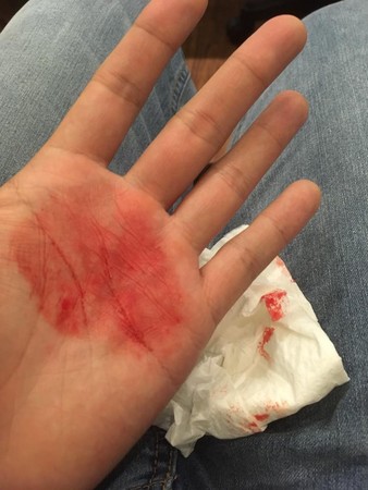 严爵头撞到柜角当场喷血_手机新浪网