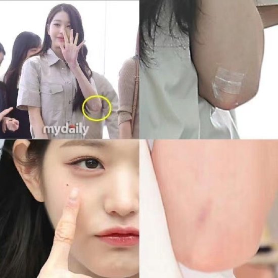 MV导演谈与张元英合作 胳膊受伤缝七针仍坚持拍摄封面图