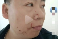 男网友合成与热巴亲吻视频被打 现已隐藏删除相关视频