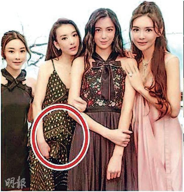 “城嫂”方媛（左二）最近出席闺密的生日派对，腹部微隆