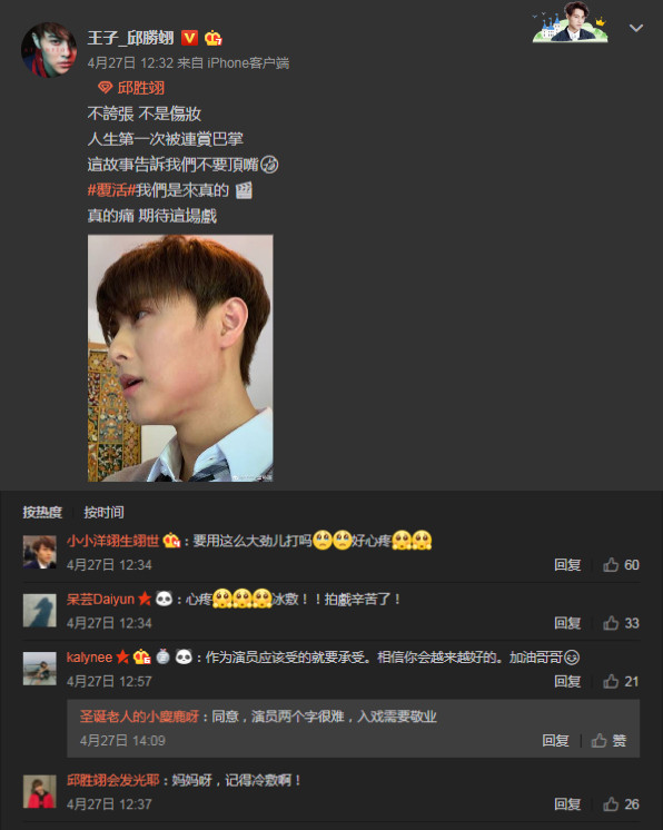 王子邱胜翊晒挨打照粉丝心疼赞其敬业哥