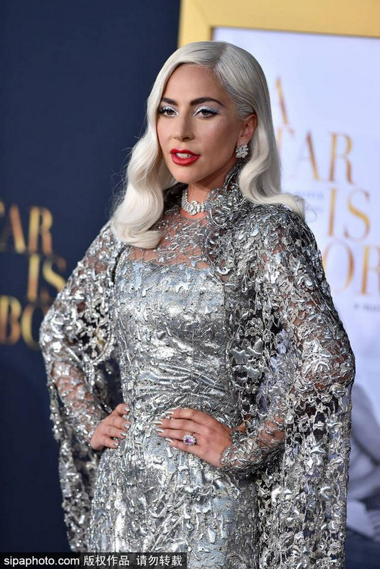 Gaga拍电影入戏太深 片场精神科医护随时待命 Gaga拍电影入戏太深 片场精神科医护随时待命