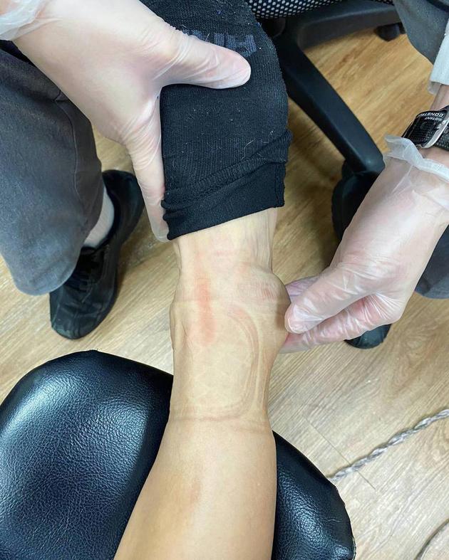 胡宇崴录节目时意外受伤右脚脚踝骨折伤势严重 胡宇崴 新浪娱乐 新浪网 胡宇崴录节目时意外受伤右脚脚踝骨折伤势严重 胡宇崴 新浪娱乐 新浪网