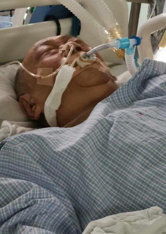 沈威在北京医院的ICU病房进行抢救