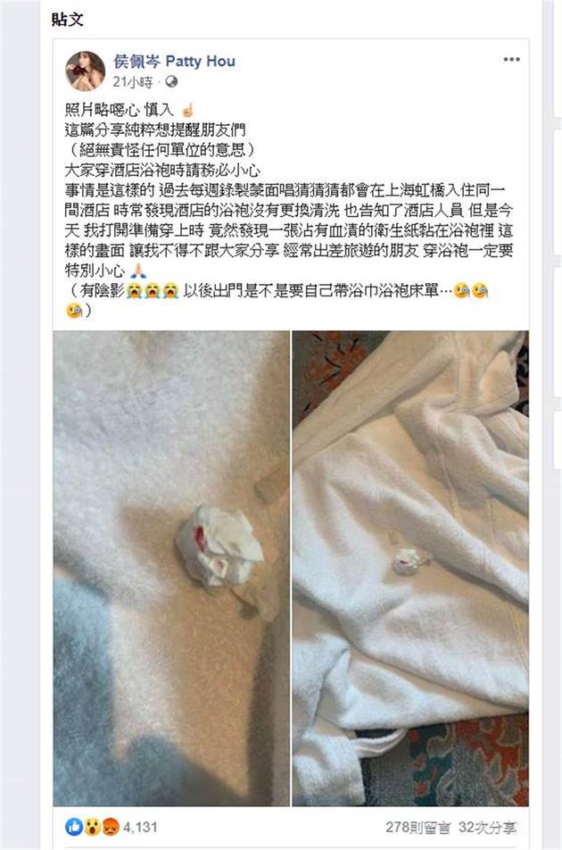 打开酒店浴袍惊见染血纸巾 侯佩岑吓傻:有阴影