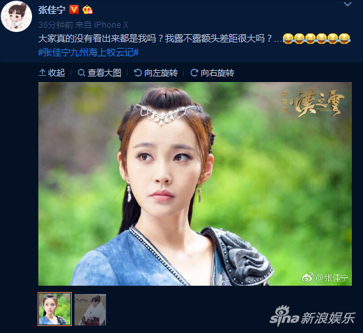 张佳宁发博调侃露额头