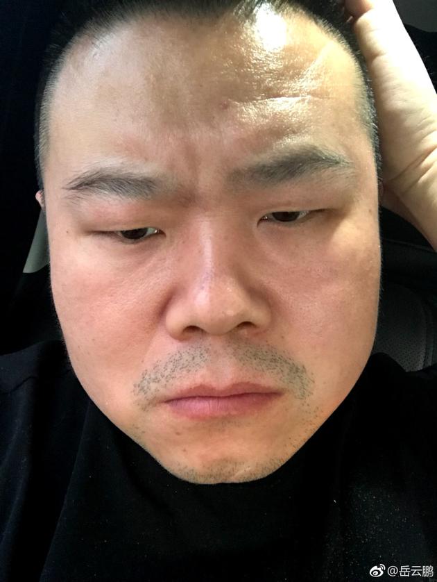 28日,喜剧演员岳云鹏晒车内自拍的照片,并搞笑的写道:"膀胱真的快