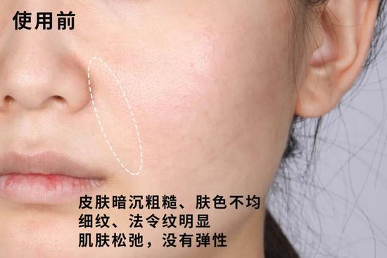 25 的中年少女们拯救初老熬夜脸的机会到了 肌肤 干燥 皱纹 新浪时尚 新浪网 25 的中年少女们拯救初老熬夜脸的机会到了 肌肤 干燥 皱纹 新浪时尚 新浪网