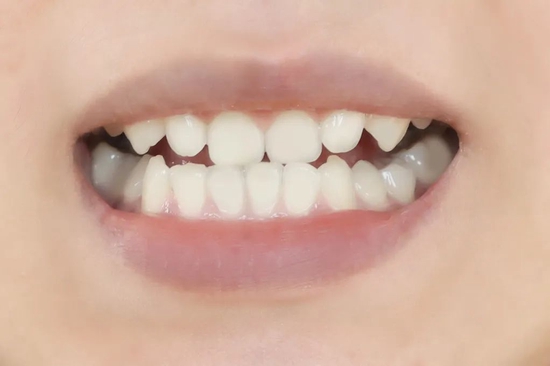 口腔cr什么意思你会注重口腔护理吗？_https://www.jmylbn.com_新闻资讯_第40张