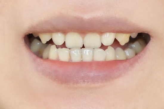 口腔cr什么意思你会注重口腔护理吗？_https://www.jmylbn.com_新闻资讯_第39张