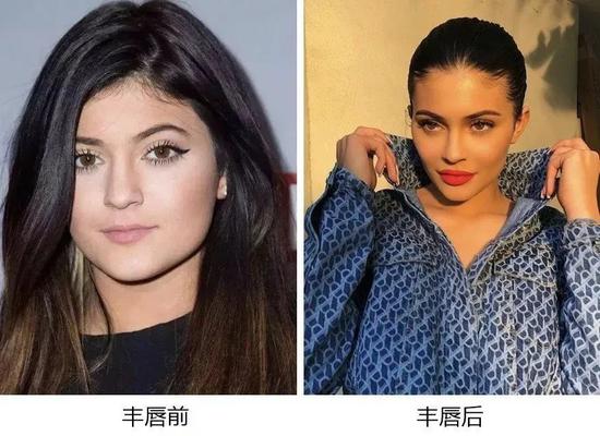 森绘梨佳涂什么口红都好看?原来多亏了她的厚唇