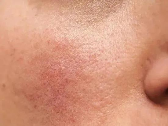 精华防晒粉底都搓泥?原来都是因为它