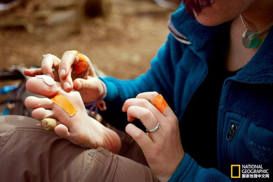 阿巴拉契亚山脉徒步道上，一名徒步者给脚上的水泡缠上绷带，防止进一步受伤和疼痛。摄影：MICHAEL D.WILSON， AURORA